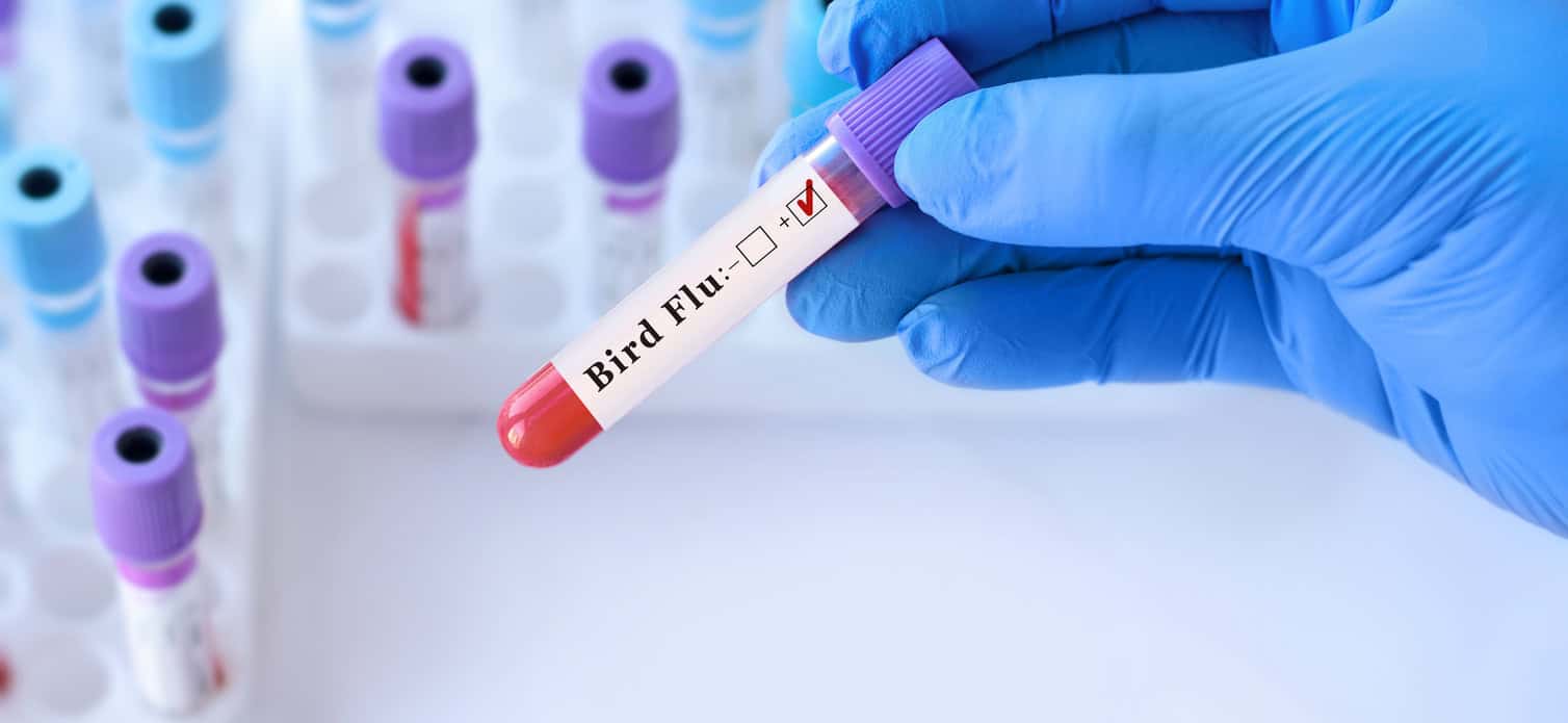 Bird Flu test